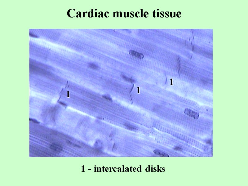 Cardiac muscle tissue 1 - intercalated disks